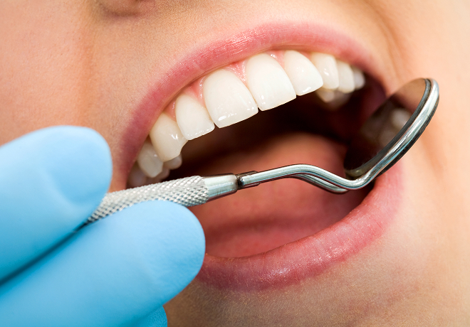 closeup of a mouth at the dentist